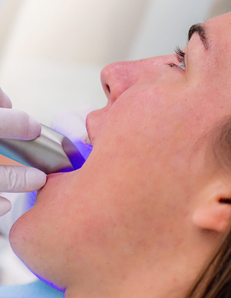 Wisdom Tooth Extractions