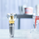 Dental Implant