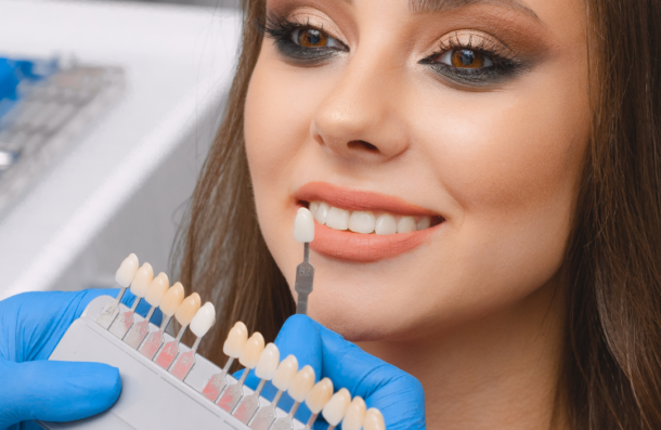 Composite Bonding shade taking