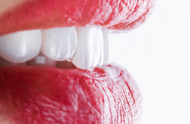 Composite Bonding close up of white teeth red lips