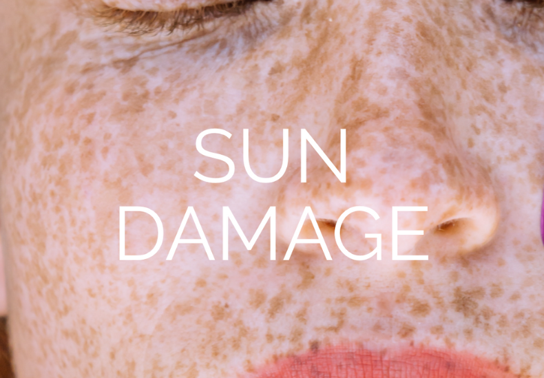 sun damage