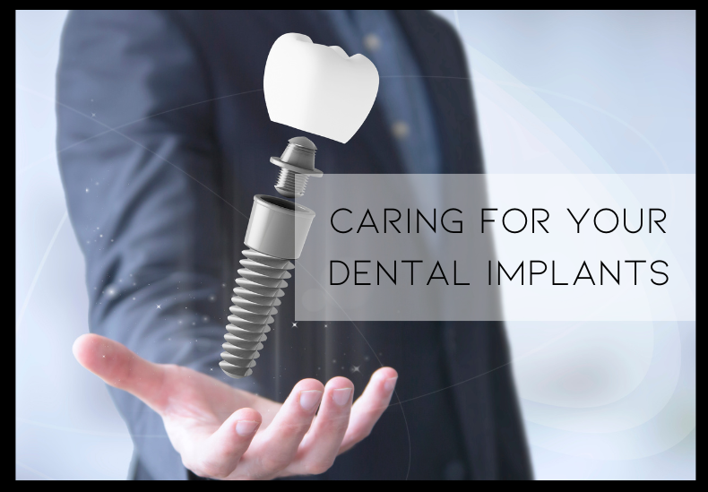 caring for dental implants
