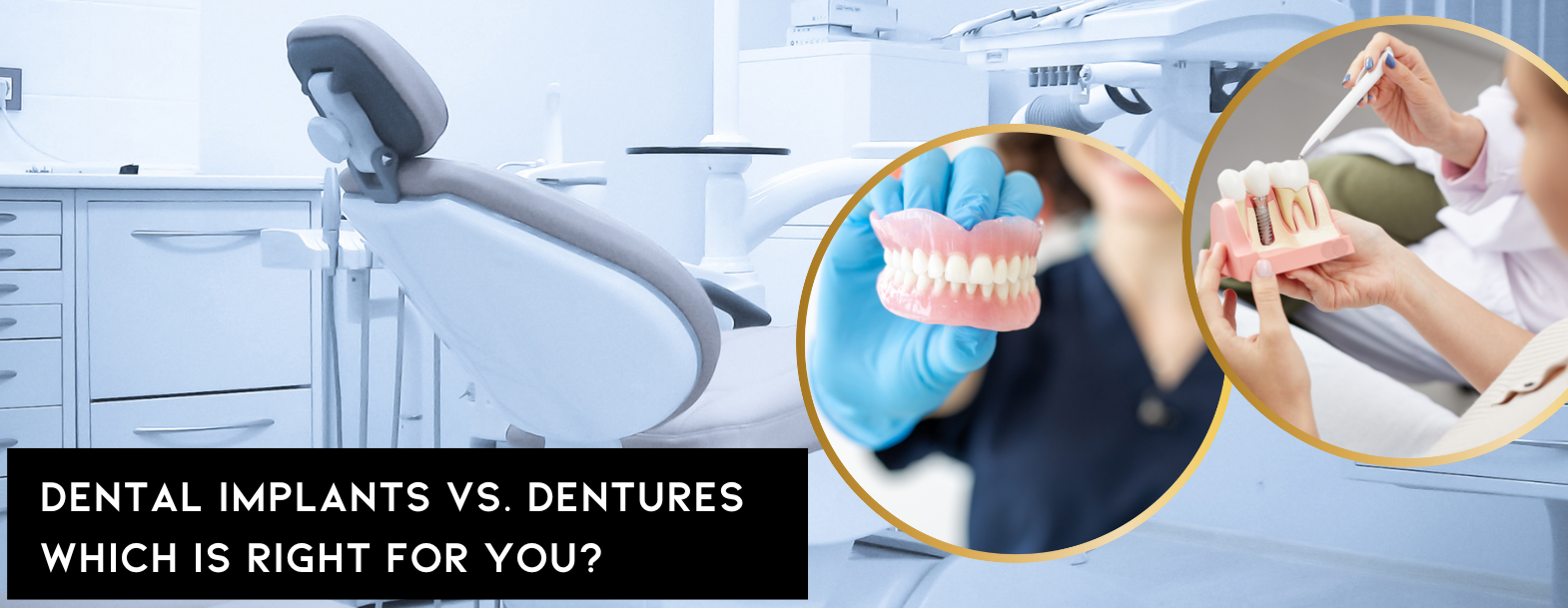 Implants vs dentures