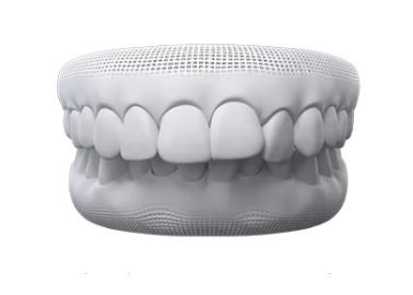 Invisalign overbite