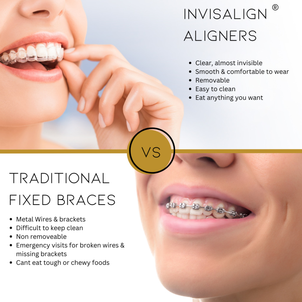 Invisalign vs fixed braces