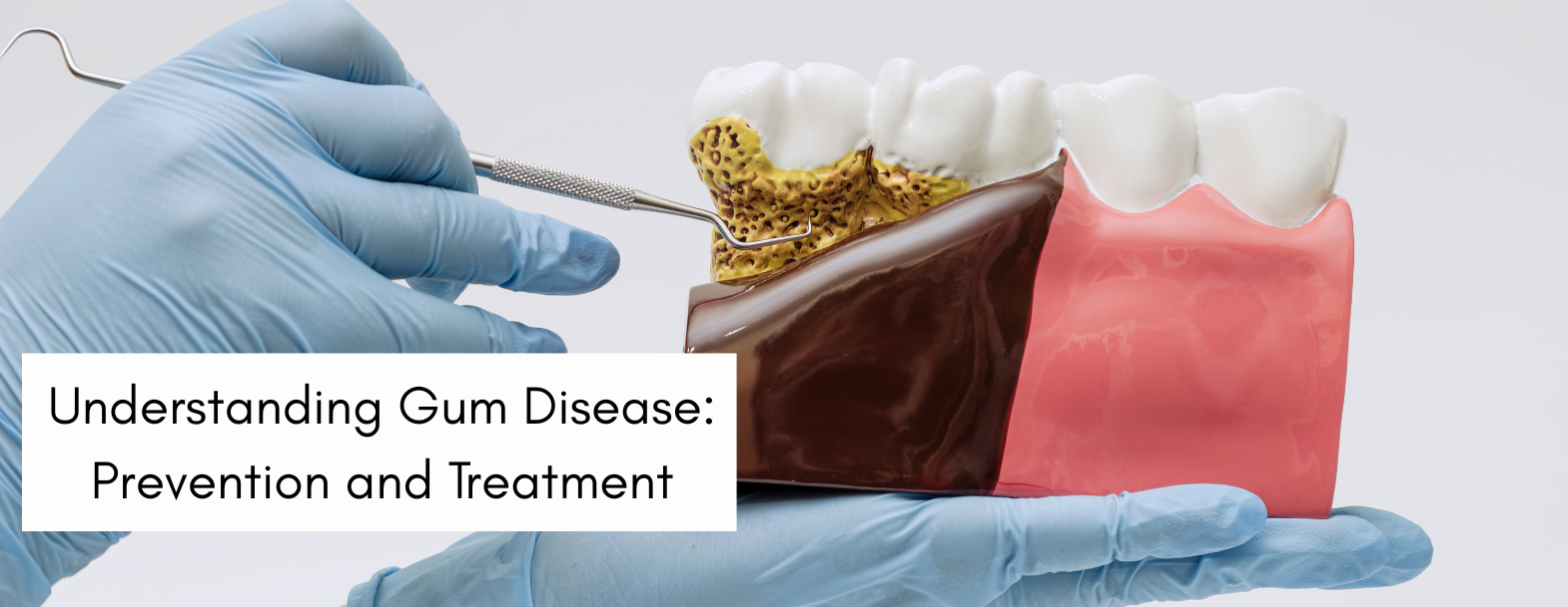 Understanding gum disease blog banner