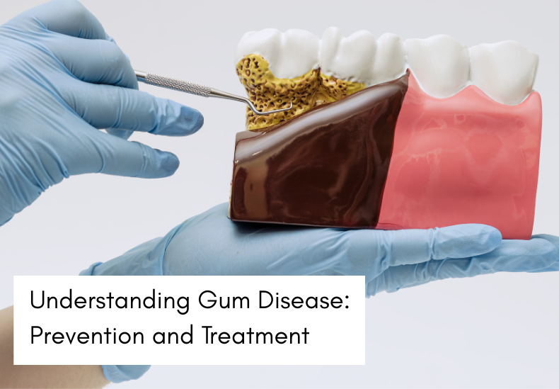understanding gum disease featured image