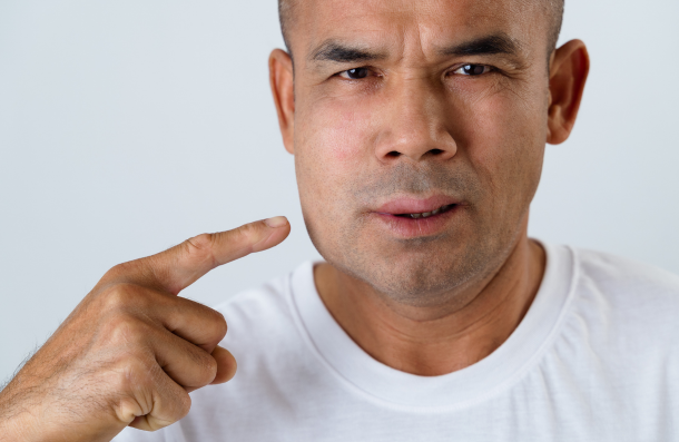 Man with facial swelling