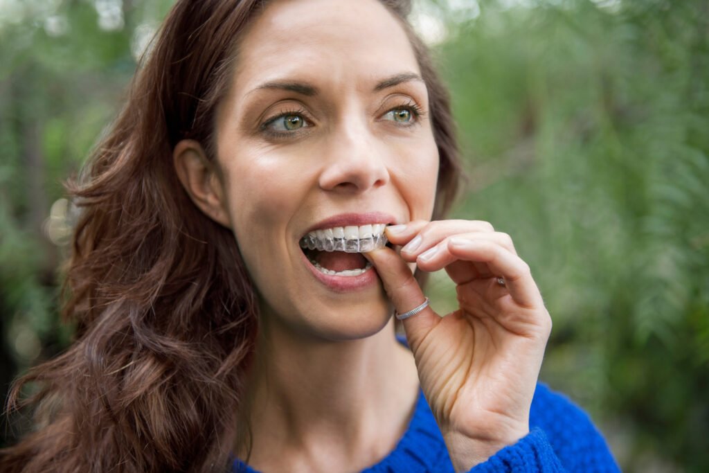 Invisalign for adults in Modbury