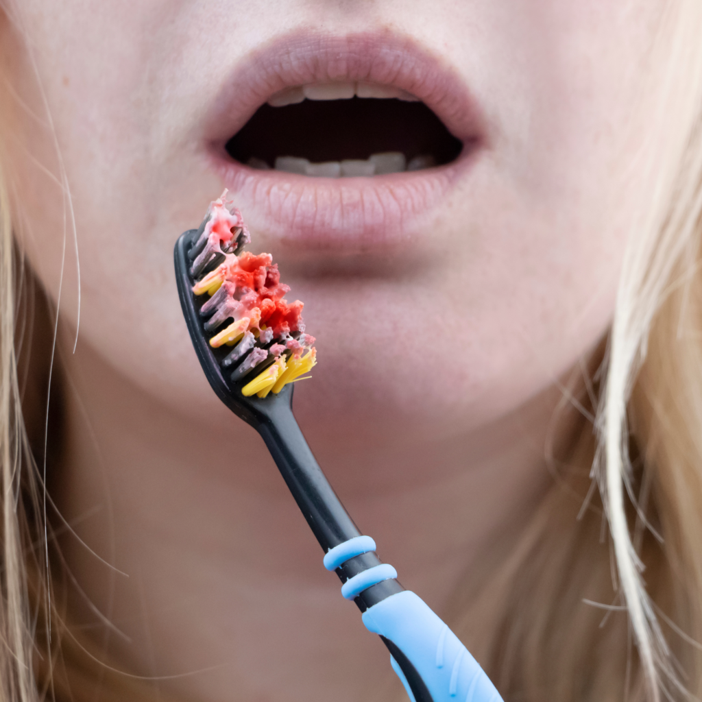Bleeding gums Modbury Dental Practice Ivybridge